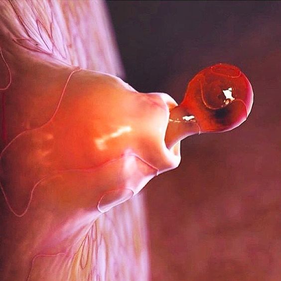 cateterdoblej's tweet photo. Inicio de la ovulación humana vista con #microscopio https://t.co/3ewClgPdXF
