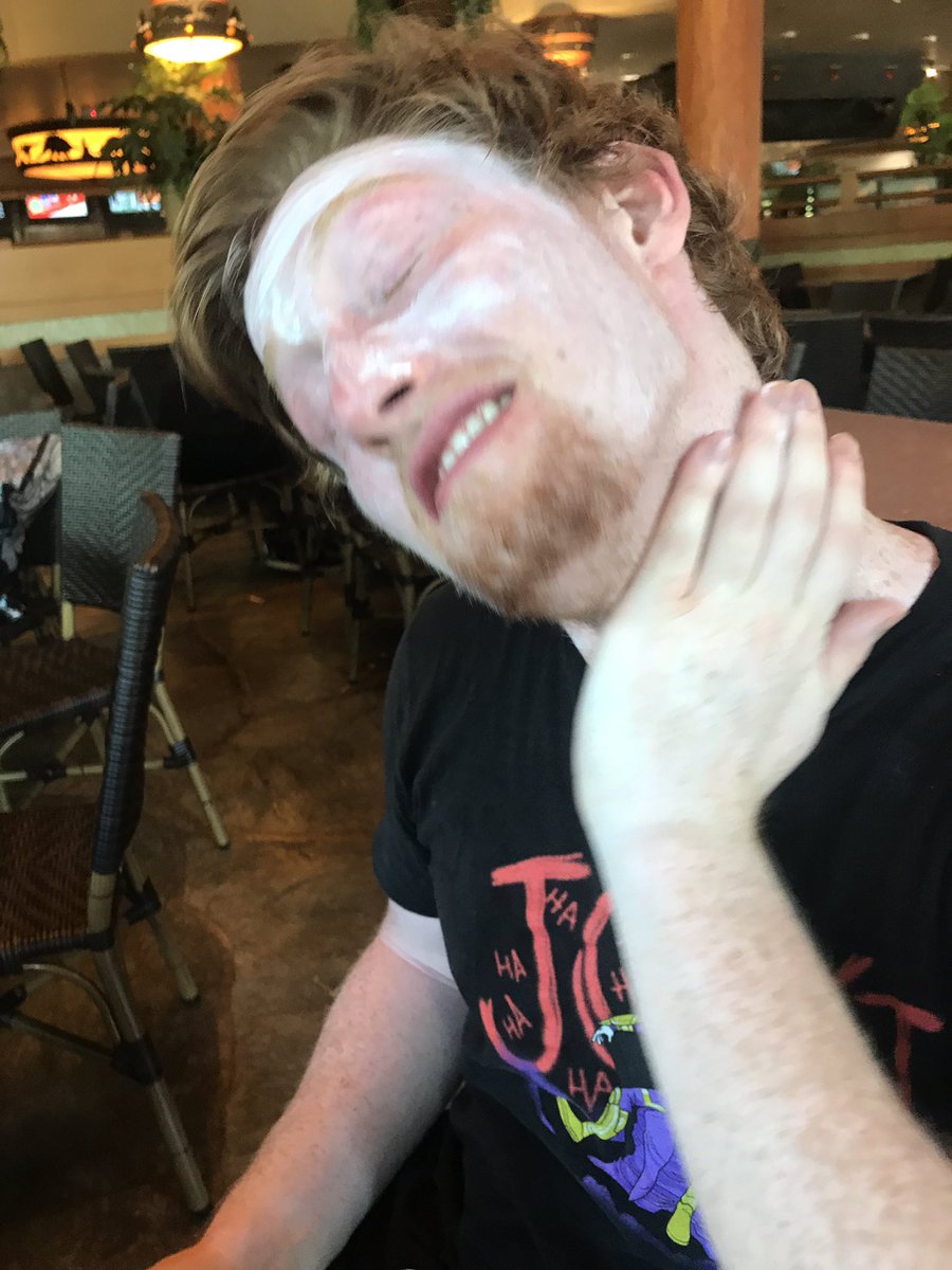 Crimsix's tweet image. Imagine the daily struggle of being a ginger...
