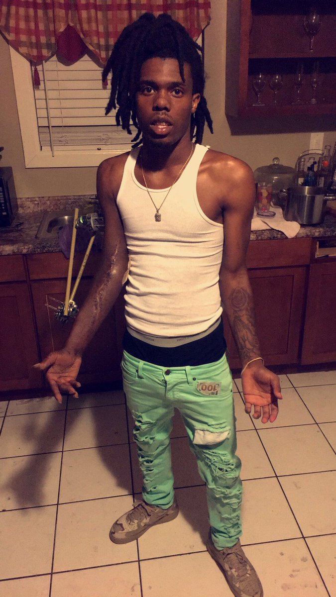 bbillions__'s tweet photo. Got shot and you can see the proof I was down for a min thanking the lord I'm still here #Grindgang💰🎒🏃🏿🤞🏽 https://t.co/jShjUm7Krw