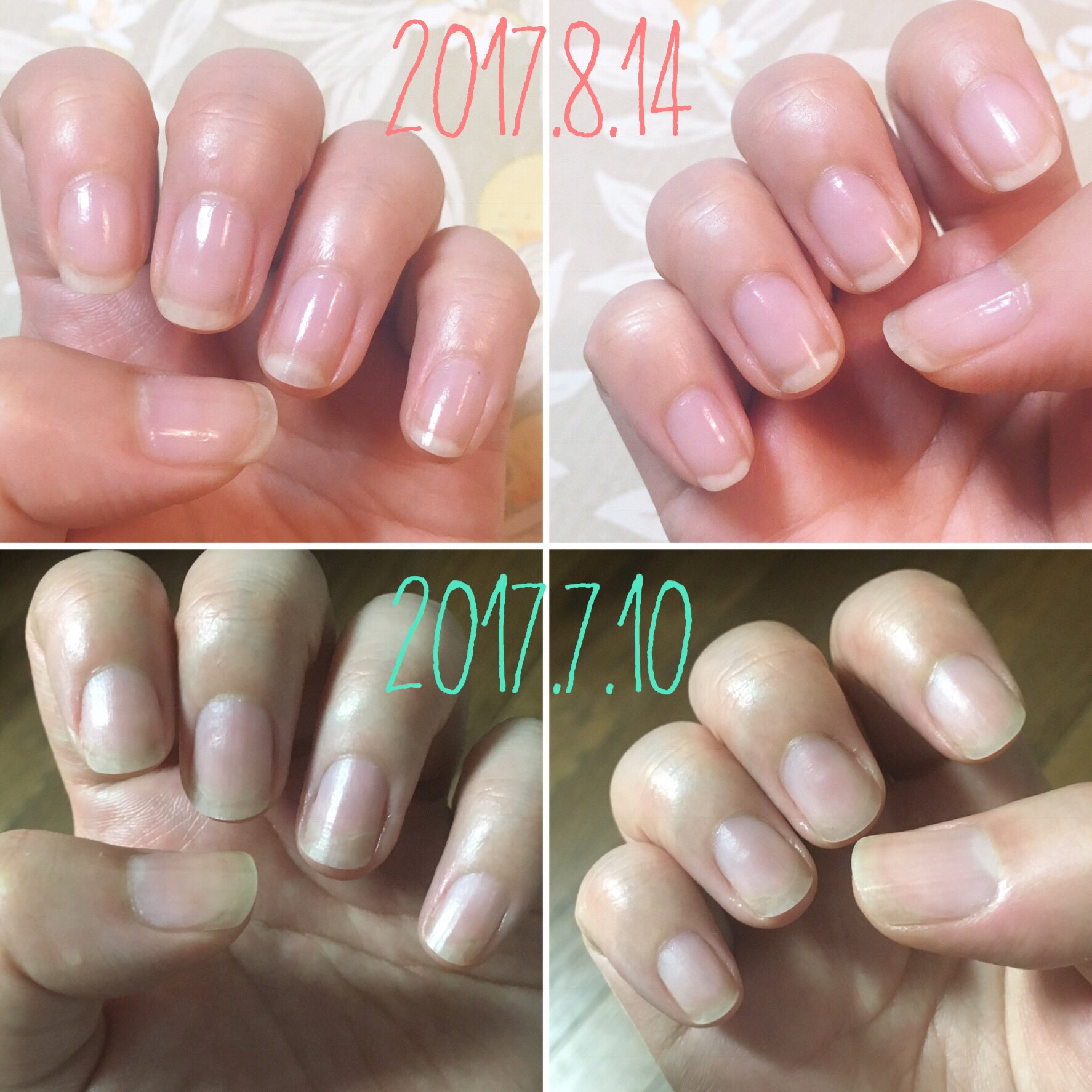ちぃち 育爪始めて最長の2週間伸ばし 先月の1週間伸ばしと比較 ネイル エンビーの光沢と写す角度マジック 笑 はあるけど それでもネイルベッドが伸びる指は着実に伸びてきてる 育爪 T Co Jm3fqhzot5 Twitter