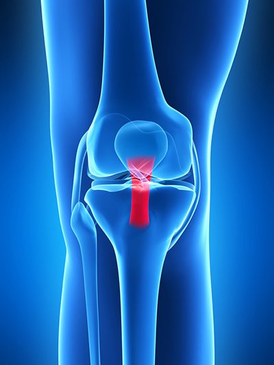 DrNickCC's tweet photo. From the lab: effect trunk position on drop-landing patellar tendon force &amp; pain https://t.co/wxh5FbuS4w Coach movement ✅💡🗣️👍 #SportsPhysio https://t.co/tBe7zarEq6