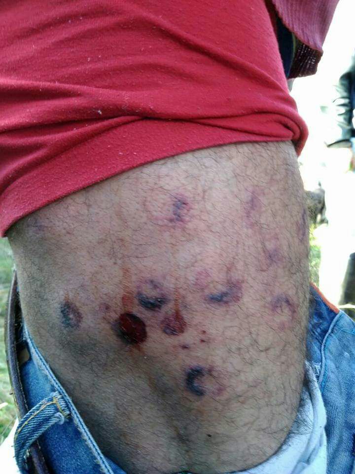AlirioUribeMuoz's tweet photo. Protesta del Mochuelo; van 20 heridos y 7 detenidos no es posible que @EnriquePenalosa y @PoliciaColombia traten así la protesta legítima. https://t.co/KYeT4qlrMh