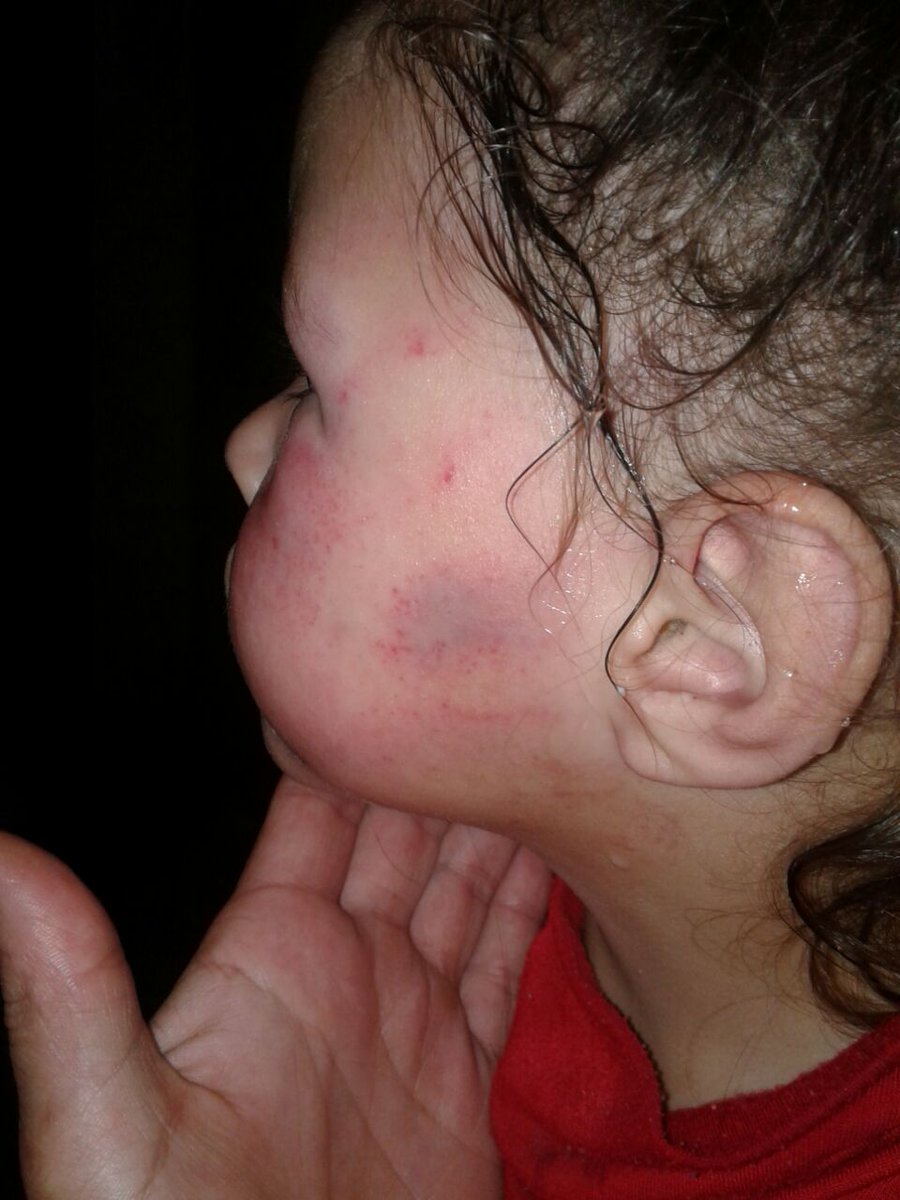 elcoya1977's tweet photo. Diana tiene 3 años.
Hoy esta bestia MATÍAS ALVES la desfiguró. Es su padrasto y está denunciado

Es de La Plata

Ayudame a que lo reconozcan https://t.co/rqc3M2CVZN