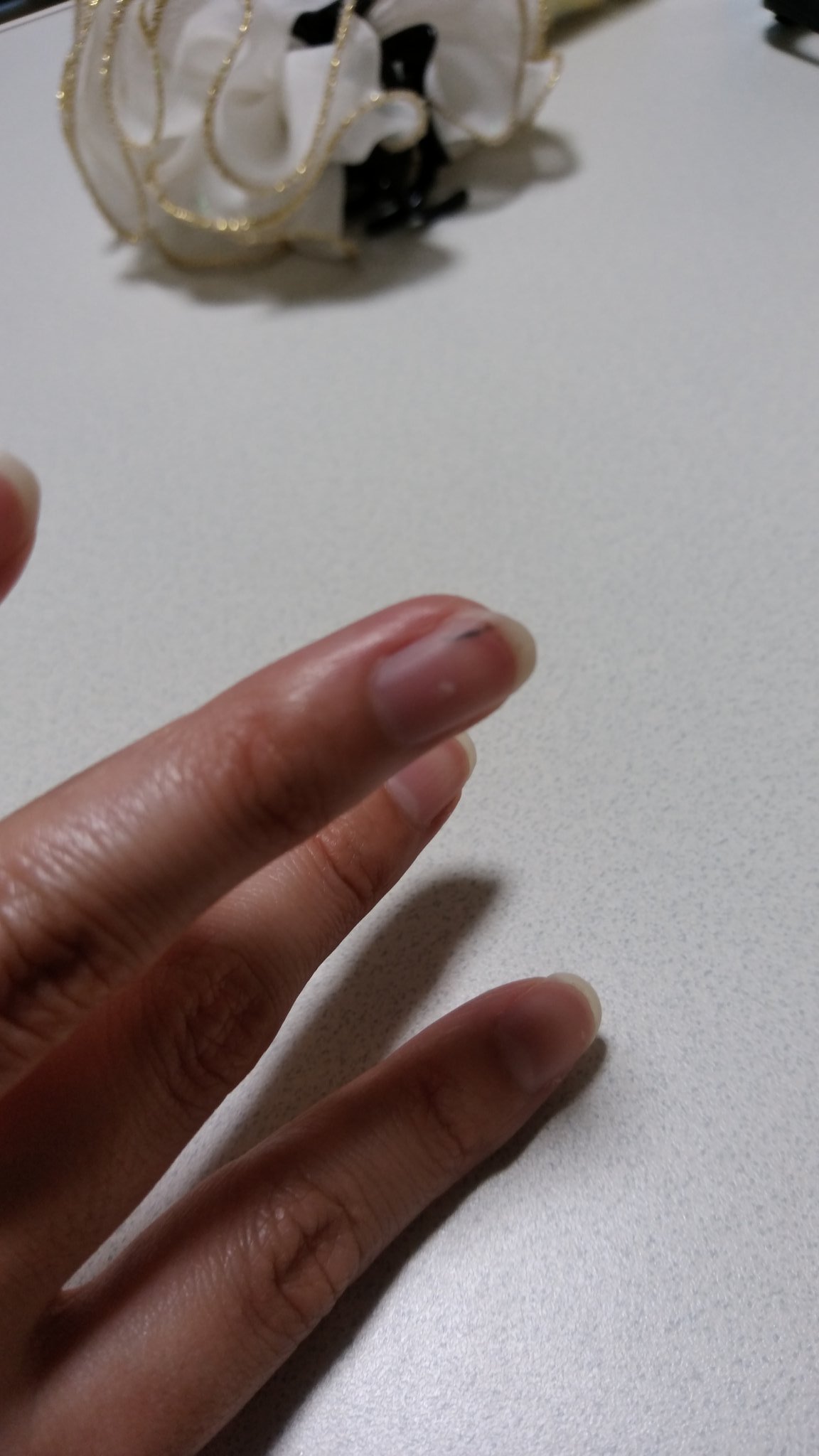 みわ 指と爪の間に棘が刺さって病院行ったけど脆いからするっと抜けなくて針入れてほじくってとってもらったんだけどクソいてぇ昔の拷問と一緒とか言われたプリズンブレイク T Co 1nn4clh6c2 Twitter
