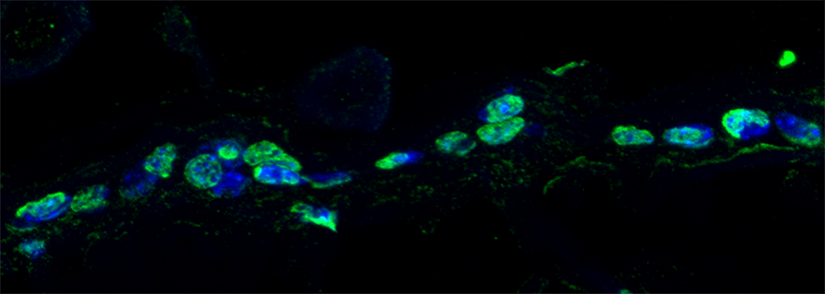 IRBBarcelona's tweet photo. "#Ageing is exacerbated by alterations of #stemcell circadian rhythm" via @scienmag
More impacts: https://t.co/I51CYVYNdp #cellfunctions https://t.co/iyPzktfcF4