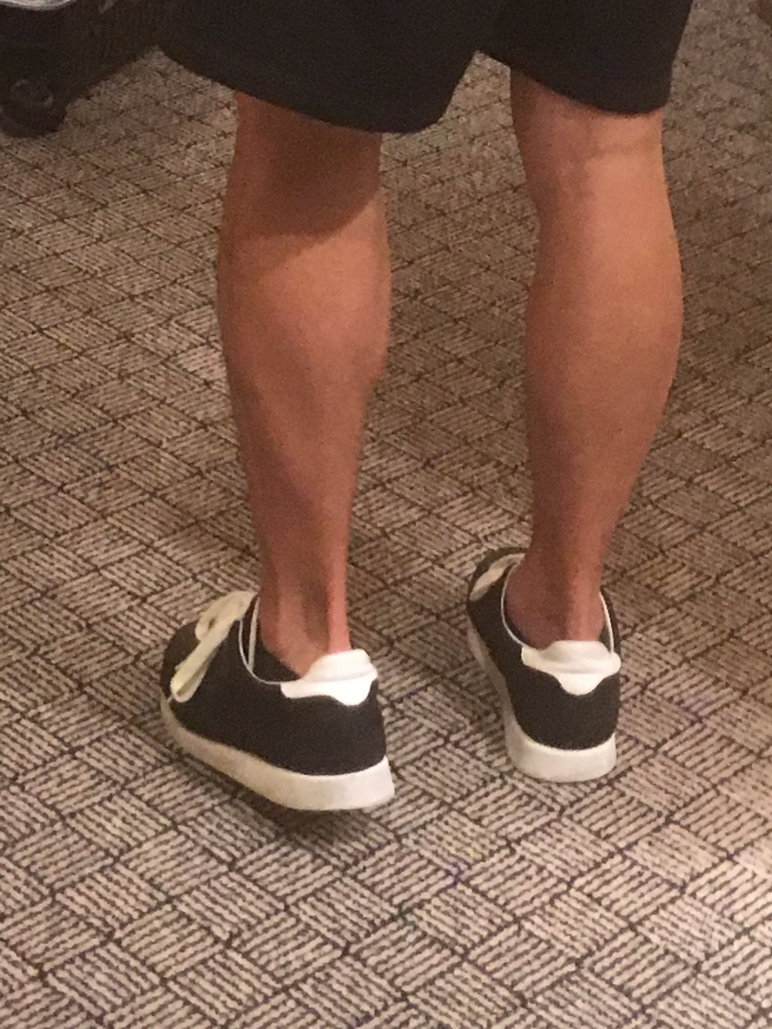 武井壮 我ながらナイスなアキレス腱や アキレスにとって唯一の弱点だったって事でアキレス腱と呼ばれてるこの腱 人体の中で最もシャレオツなネーミング 涙骨と並ぶ情緒溢れる部位 恥骨と対極をなす部位 恥骨ってなんとかしたれよ٩ ᐛ و