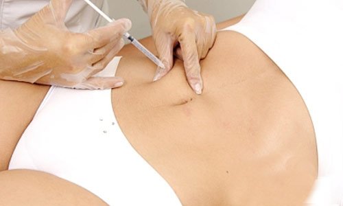 CyndirellaE's tweet photo. Mesoterapia+ondas rusas+presoterapia+laserlipolisis .4 sesiones a un precio increíble!!! NO TE PIERDAS ESTA INCREÍBLE PROMO DURANTE AGOSTO!! https://t.co/ye2MNxEySF