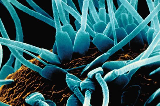 cateterdoblej's tweet photo. Espermatozoides intentando fecundar un óvulo vistos en #microscopio SEM y coloreados https://t.co/1R29zQabIN