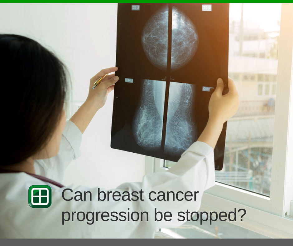 TechnolineMalta's tweet photo. Study finds switching off protein produced in #BreastCancer cells can stop cancer progression https://t.co/7NpoEYHkS4 #TechnolineMalta https://t.co/Z1ITr5Ctxn