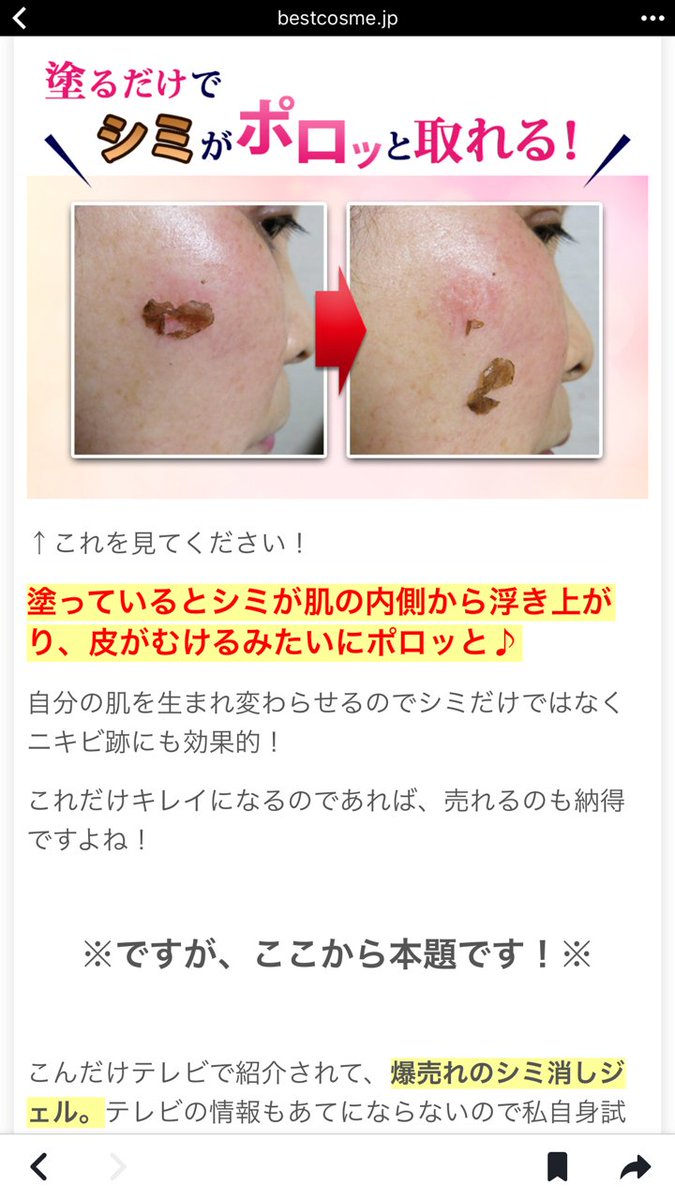 Rico 私のブログ Rico S Room2 から Ricoママの画像 を無断転載されてしまいました 荘内病院形成外科にて シミ取りのレーザー治療を行った時のビフォーアフターの写真を これを塗るだけでシミが取れる という広告に使われています T Co Rico 私のブログ Rico S Room2 から Ricoママの画像 を無断転載されてしまいました 荘内病院形成外科にて シミ取りのレーザー治療を行った時のビフォーアフターの写真を これを塗るだけでシミが取れる という広告に使われています T Co