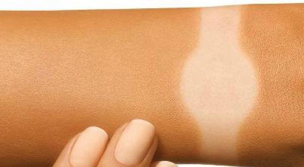 TeamRunner4Life's tweet photo. Retweet if you have awkward tan lines https://t.co/tVLs4RS9j8