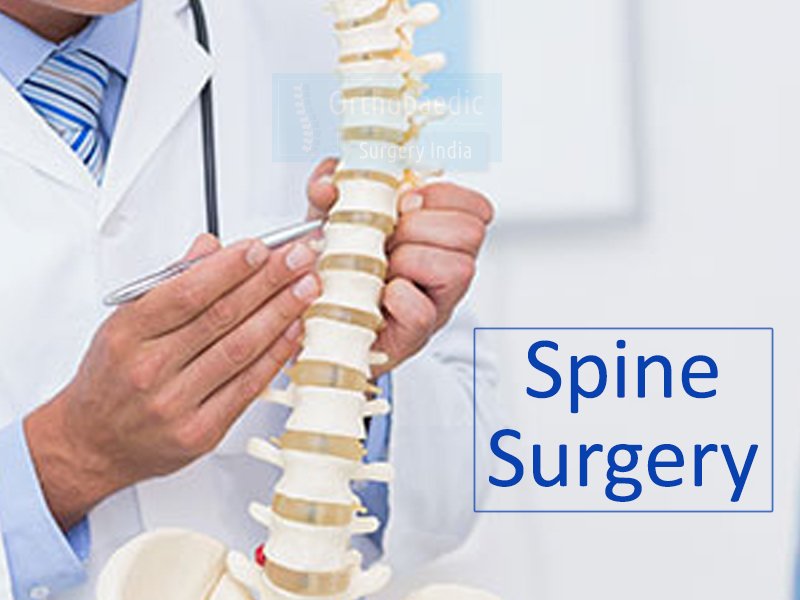 orthosurgeryin's tweet photo. Advantages of #Minimally #Invasive #Spine #Surgery in India. https://t.co/twHeyYkqru https://t.co/IE6DdgTsYg