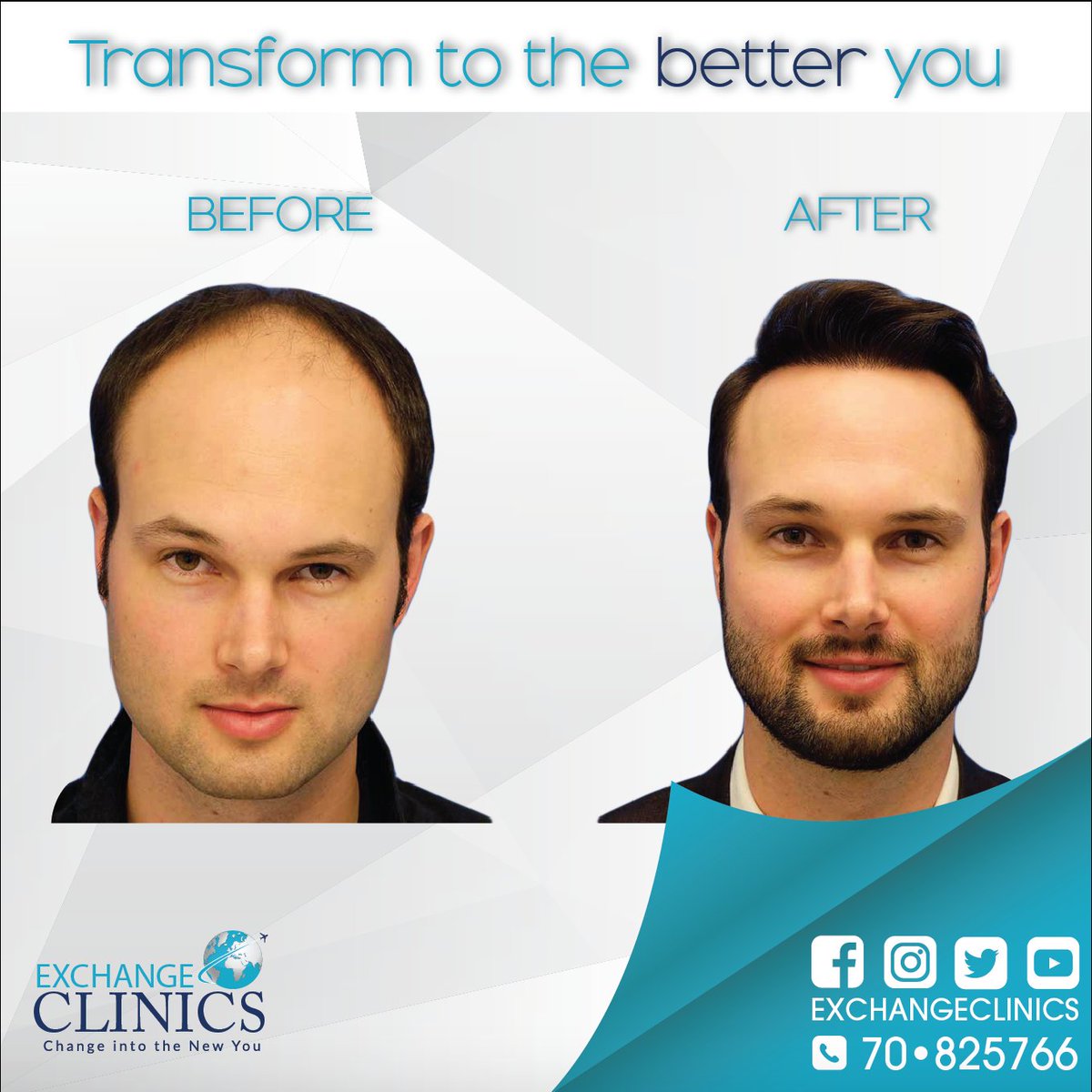 exchangeclinics's tweet photo. Transform to the better you
#Botox_injection
#Exchange_Clinics change into the new you
for more info call +961 70 825 766 https://t.co/HyyNpuJ817