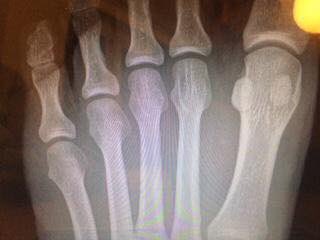 _MetaSox's tweet image. Great feedback from the GB Hockey team 👍🏑

Order yours today at metasports.com/metasox/

Use 'Nick1' for discount

#DerbyshireIS #MetaSox