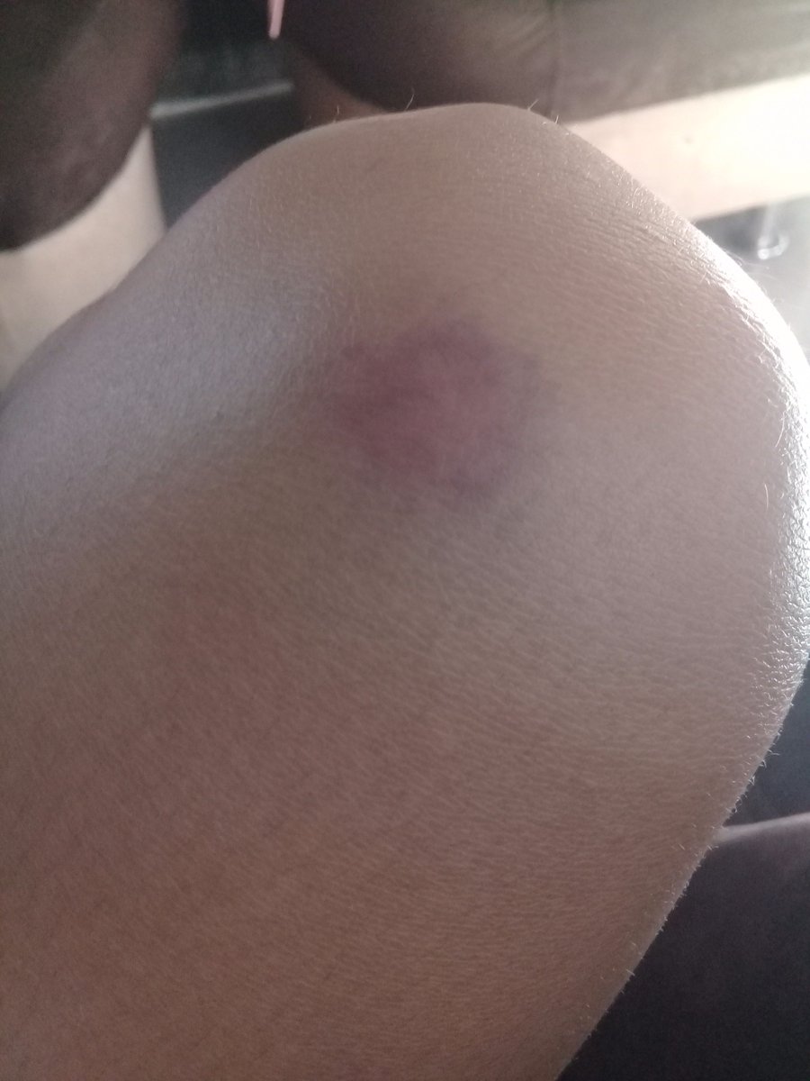 Itsricachu's tweet image. 😭