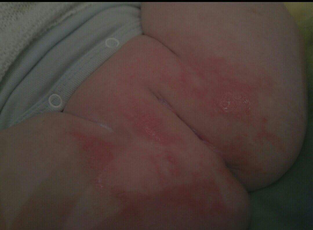 Kansas06 (@kansas062) on Twitter photo 