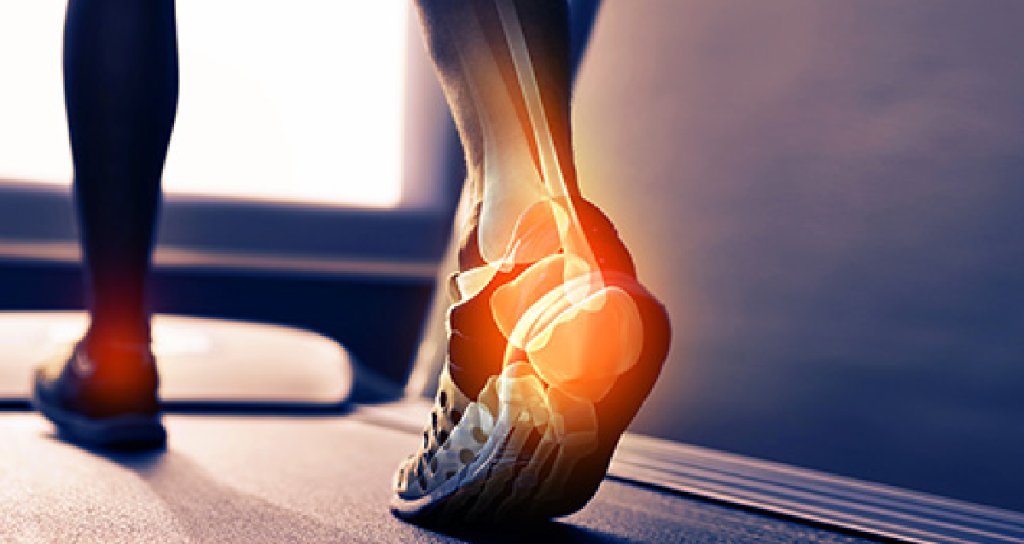 webmd heel spur