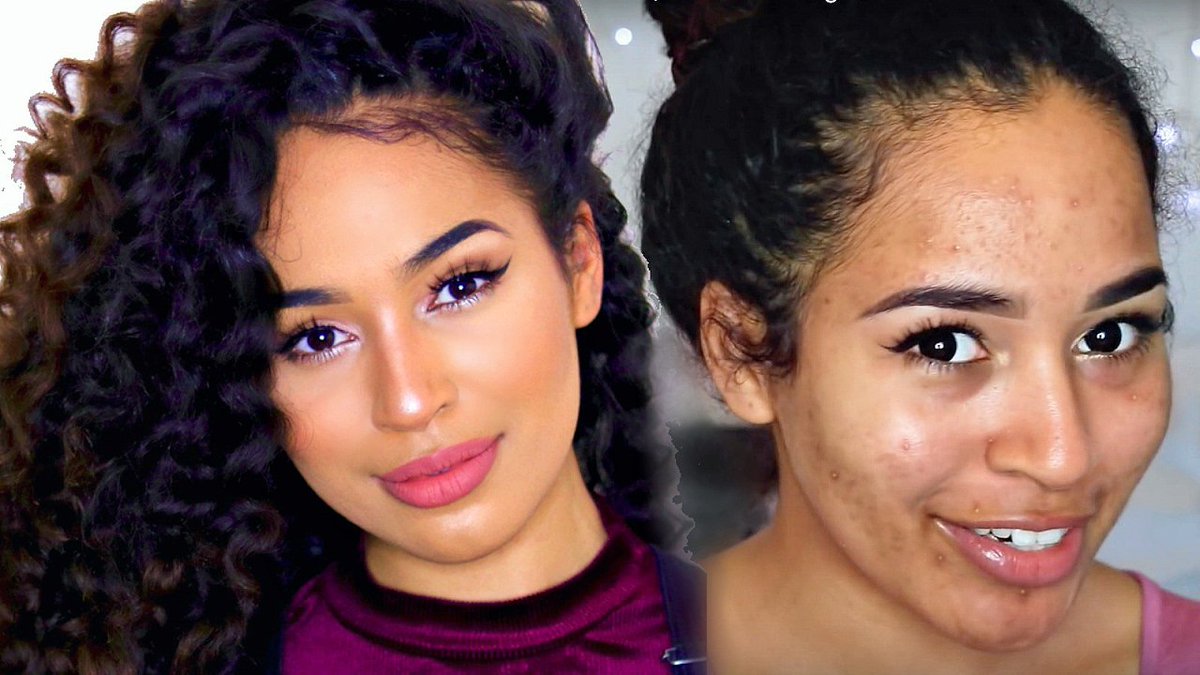 mytotalskincare's tweet photo. Flawless Winter Skin - Foundation ... - #AcneCoverage #AcneProneSkin #EverydayMakeup #ForAcne #FoundationRoutine - https://t.co/MHk96z6zsy https://t.co/bLTe33qp7I