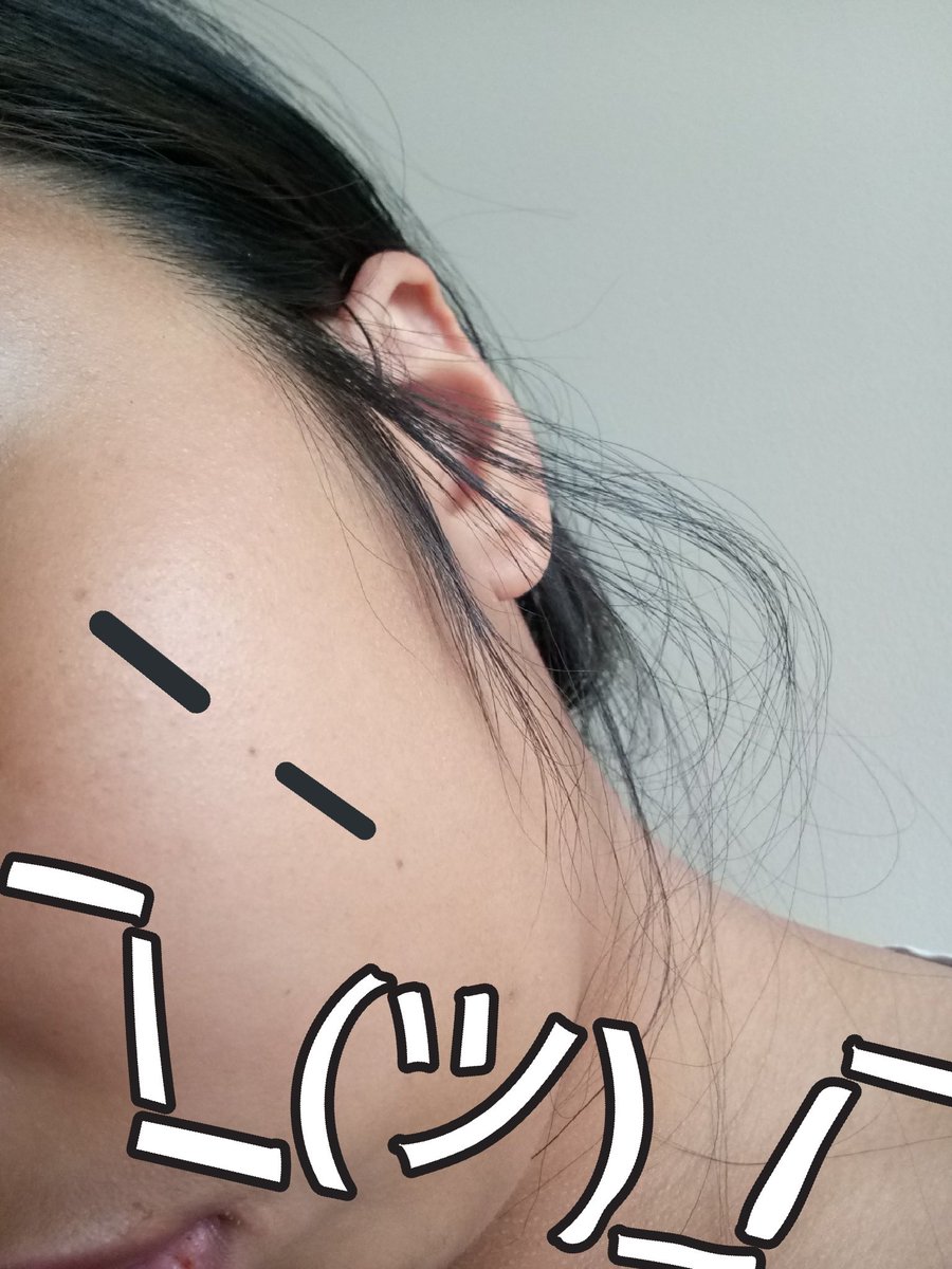 J4SONTODDS's tweet photo. soulmate au where my soulmate has the same collinear beauty mark as I. https://t.co/0bdvY4Z6Va