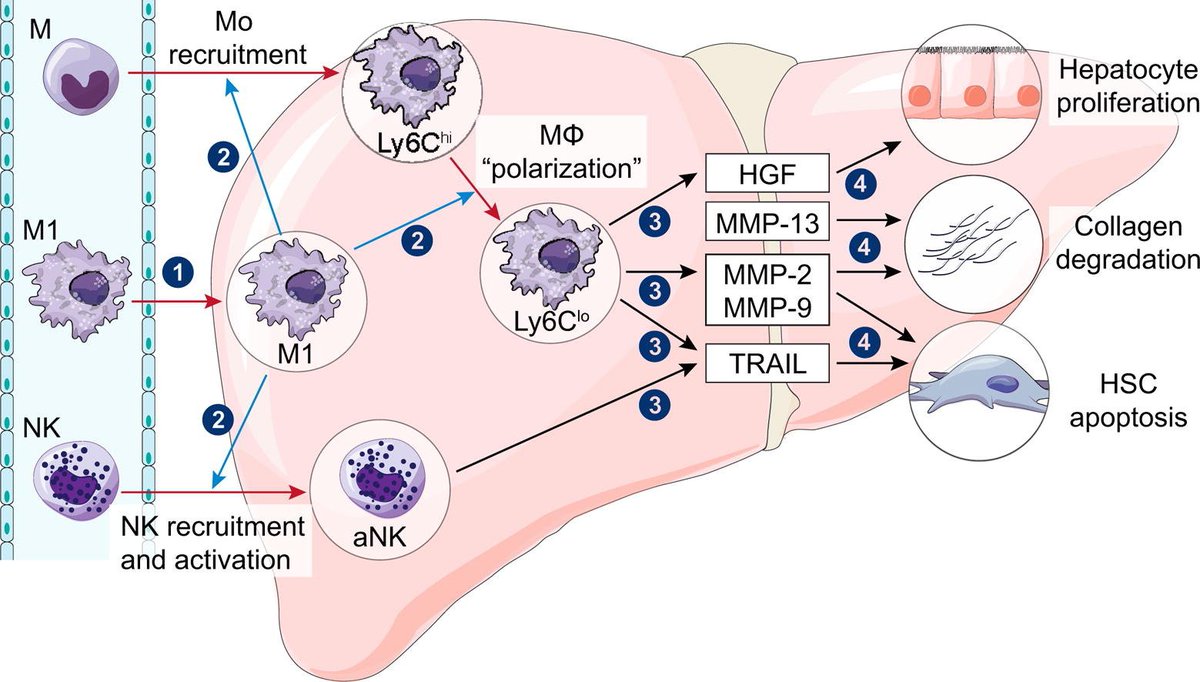 JHepatology's tweet photo. M1 #BMDMs exhibit stronger #therapeutic effects in #liver #fibrosis than M0 BMDMs
https://t.co/MOywjyMTyB
#cytotherapy #Immunology https://t.co/V1V2ATTpFr