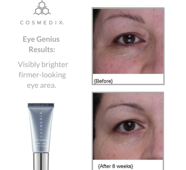 changeswc's tweet photo. Eye Genius 8 week results @COSMEDIX  #antiaging #skincare #WalnutCreek #spa https://t.co/hK1Hz76nyF