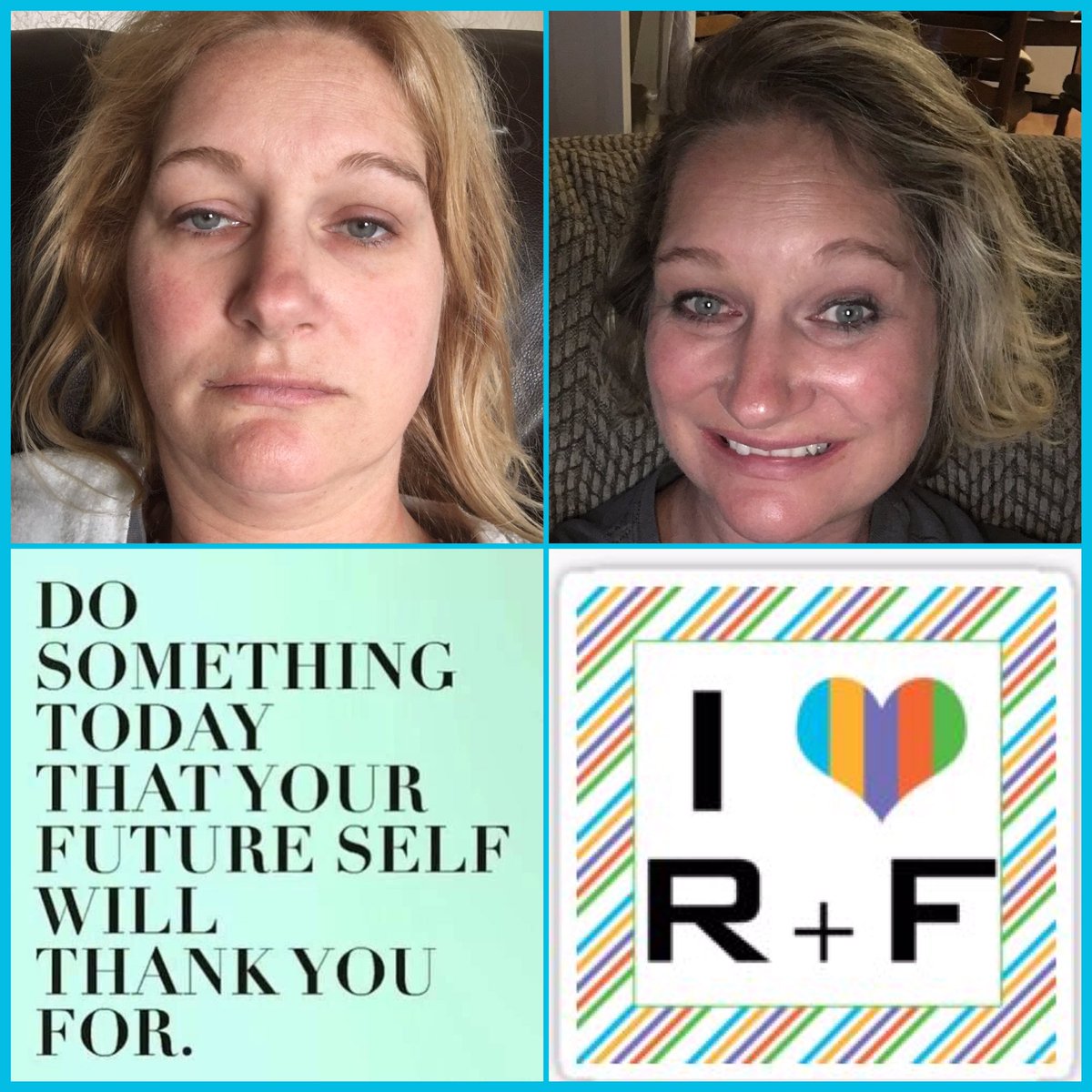 Windingrootstn's tweet photo. here's my #Story I started my #RodanandFields story  a year ago.  I can't my #Skin has changed.  Look how #dull and #lifeless it was. https://t.co/JadowyY44U