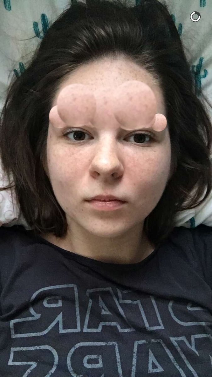 rachelpiasecki's tweet image. i woke up like this #nomakeup #somanyproblems