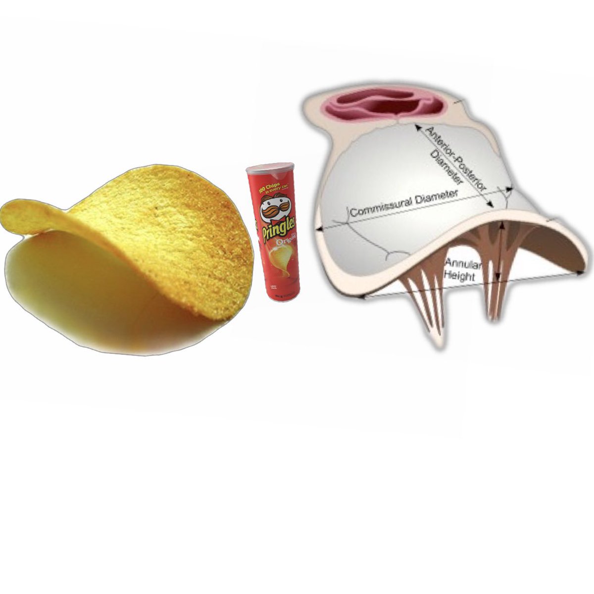 It's about time to change the description of MV annular geometry from saddle-shaped into something current med students can better relate to