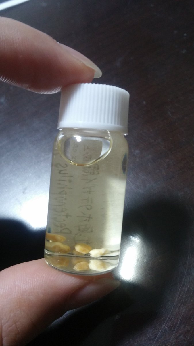 鷲宮ほうき En Twitter カイアシ類の１種 ホタテエラカザリを見つけた やっと見つけた