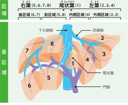 pepeko2's tweet photo. 「腫瘍が1つのみ」「大きさが2センチ以下」「脈管（門脈、静脈、胆管）に広がっていない」https://t.co/P7cPtEKlH1 https://t.co/rZ71889Vi7