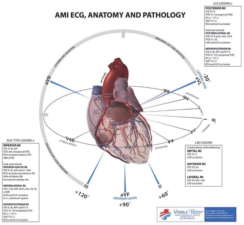 EM_RESUS's tweet photo. Be able to connect all three:

1. Coronary Anatomy
2. ECG Leads
3. Echo Territories 

#FOAMed https://t.co/meGztIjqi2
