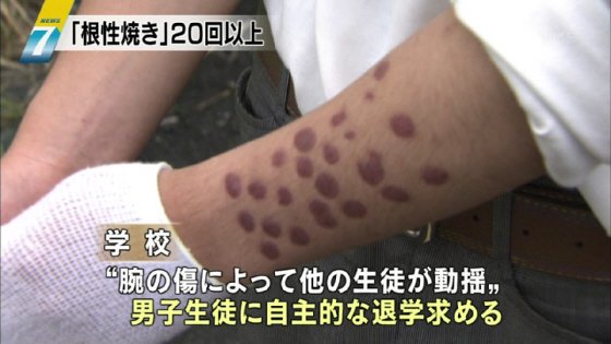 katakataiwashi's tweet photo. ちょっと気になって調べてみたら、この学校いろいろやらかしてたんだな…
起こるべくして起き、甲子園という大舞台だったからこそ表面化したのかな
あの蹴り方じゃあ今までにも犠牲者沢山いそう

#渡部夏史
#仙台育英 https://t.co/AIOdZtbR5f