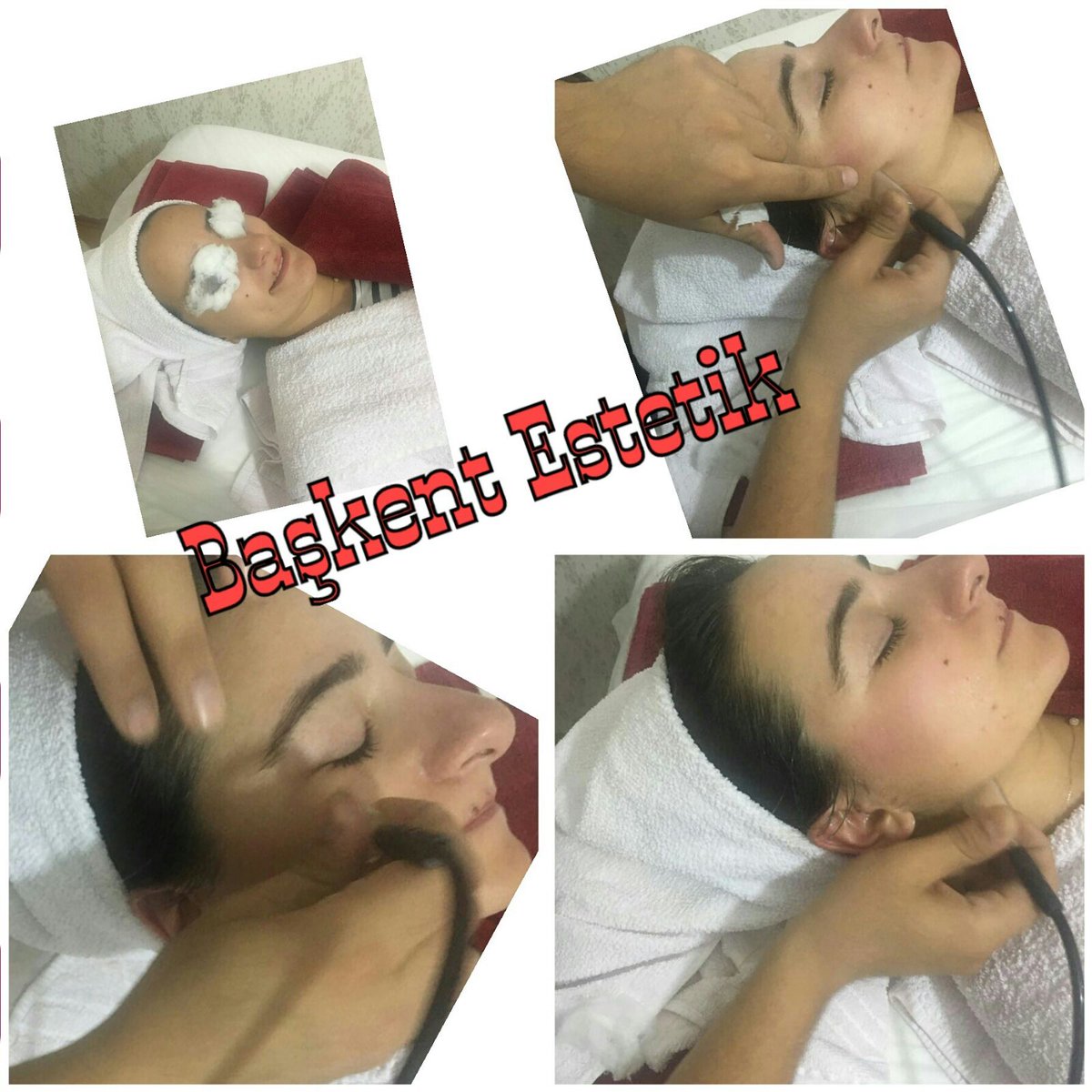 #ciltbakımı #estetik #güzellik #bakım #indirim #kampanya #ankara #tunalıhilmi #cankaya #kızılay #çankırı #kırıkkale #çorum #amasya #niğde