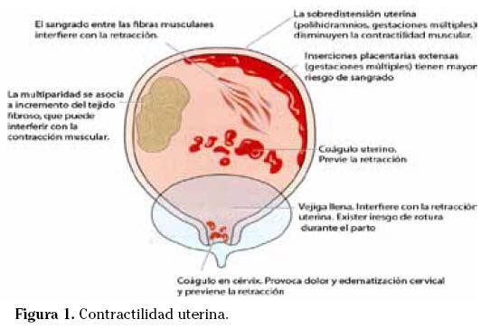 Anaesthetist_81's tweet image. Las 4 &apos;T&apos; para hemorragia obstétrica #Anestesia #AnestesiaObstétrica #HemorragiaObstétrica