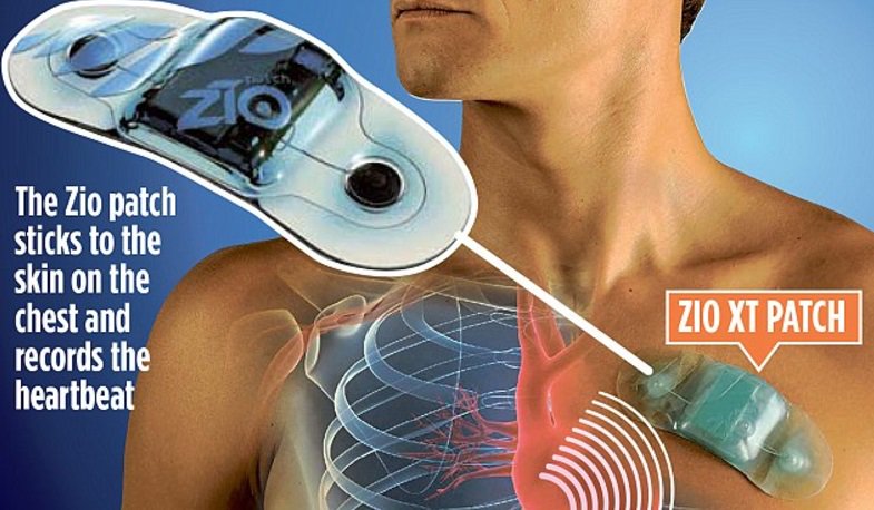 TheHolly_'s tweet photo. New Innovative Test Available for Patients with Cardiac Arrhythmia's - #ziopatch #ZIOXT Patch Test  https://t.co/uAYpzuhQU2 https://t.co/iYluZGyPtC