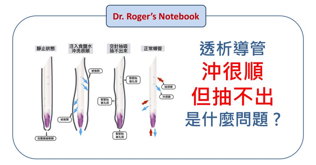 drrogercc's tweet photo. 透析導管抽不出血來 但是沖的時候很順 是怎麼回事？ https://t.co/eHyjujIX3E https://t.co/MBQVfrJkfX