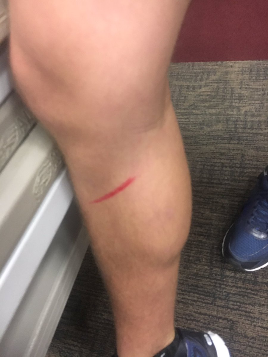 Noah02130's tweet photo. @BandAssassins I got emmm!!!!!!! Cameron is out https://t.co/jsscSRL7xy