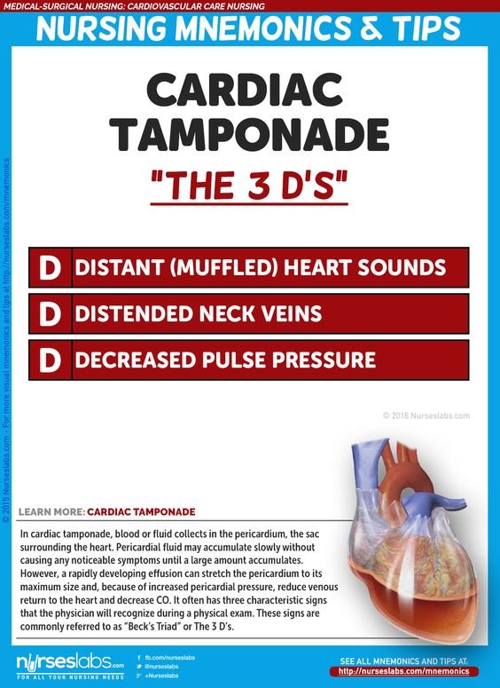 Clinical_Queen's tweet photo. #Nursing #CardiacTamponade #Nurse #NursingStudent #NursingSchool #Clinical_Queen #RN #Medicine https://t.co/Q4RIW4p0Sw