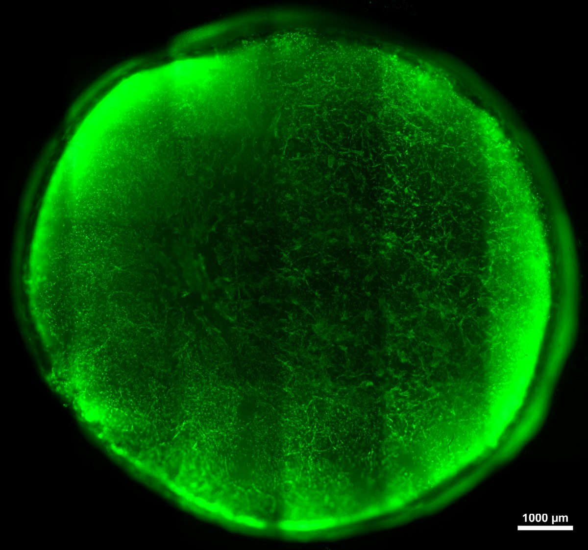 DavidWalsh_MPSI's tweet photo. Dendrimer loaded gene activated scaffolds for tissue repair from @TissueEngDublin @RCSIPharmacy  &amp; @TRENDMATERIALS1 https://t.co/soQ9OuJ8dU https://t.co/GSti9uNeV4