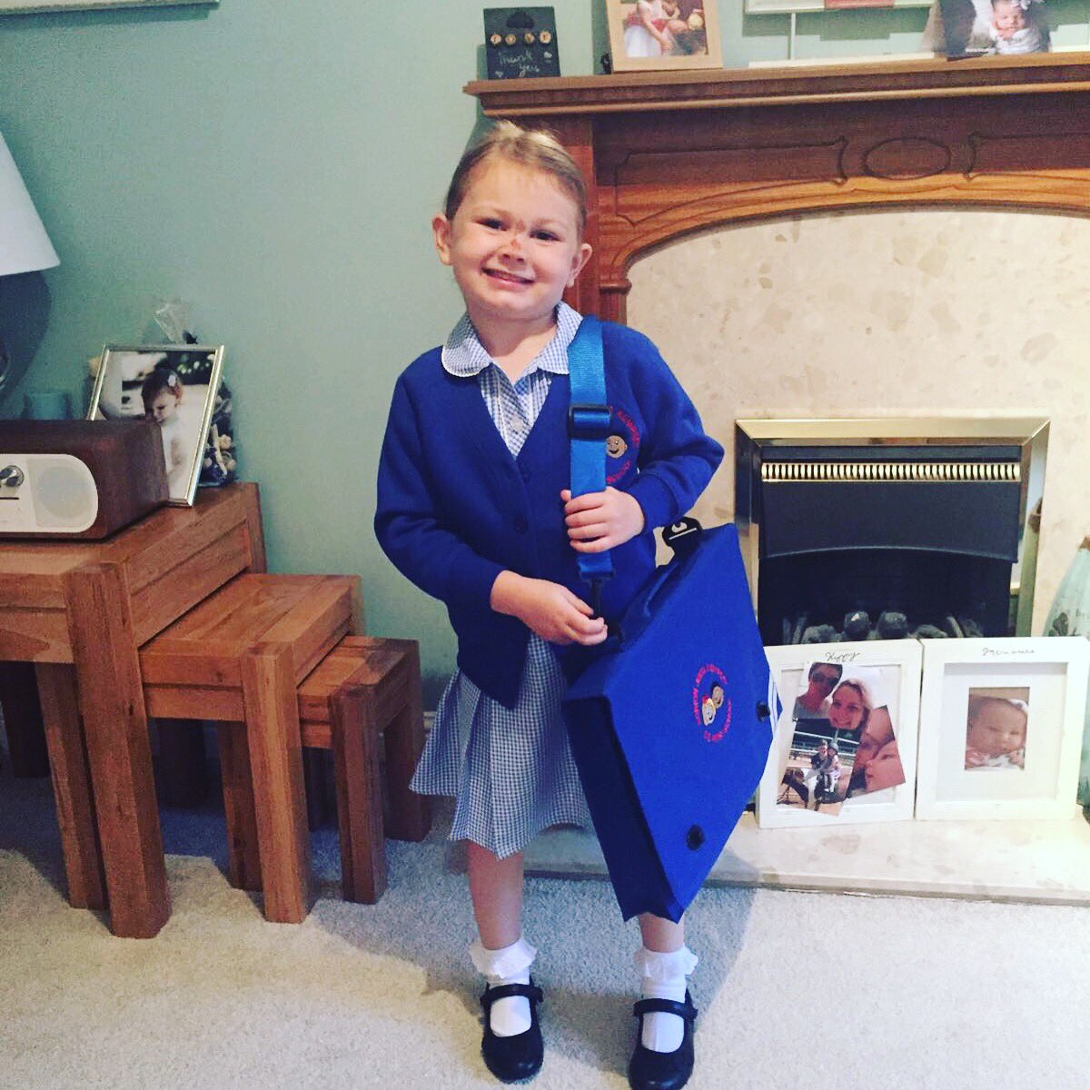 CoxLynsey's tweet photo. Look at this big girl #1stdayatschool #bruisedface 😆 https://t.co/lpMStdNMZK