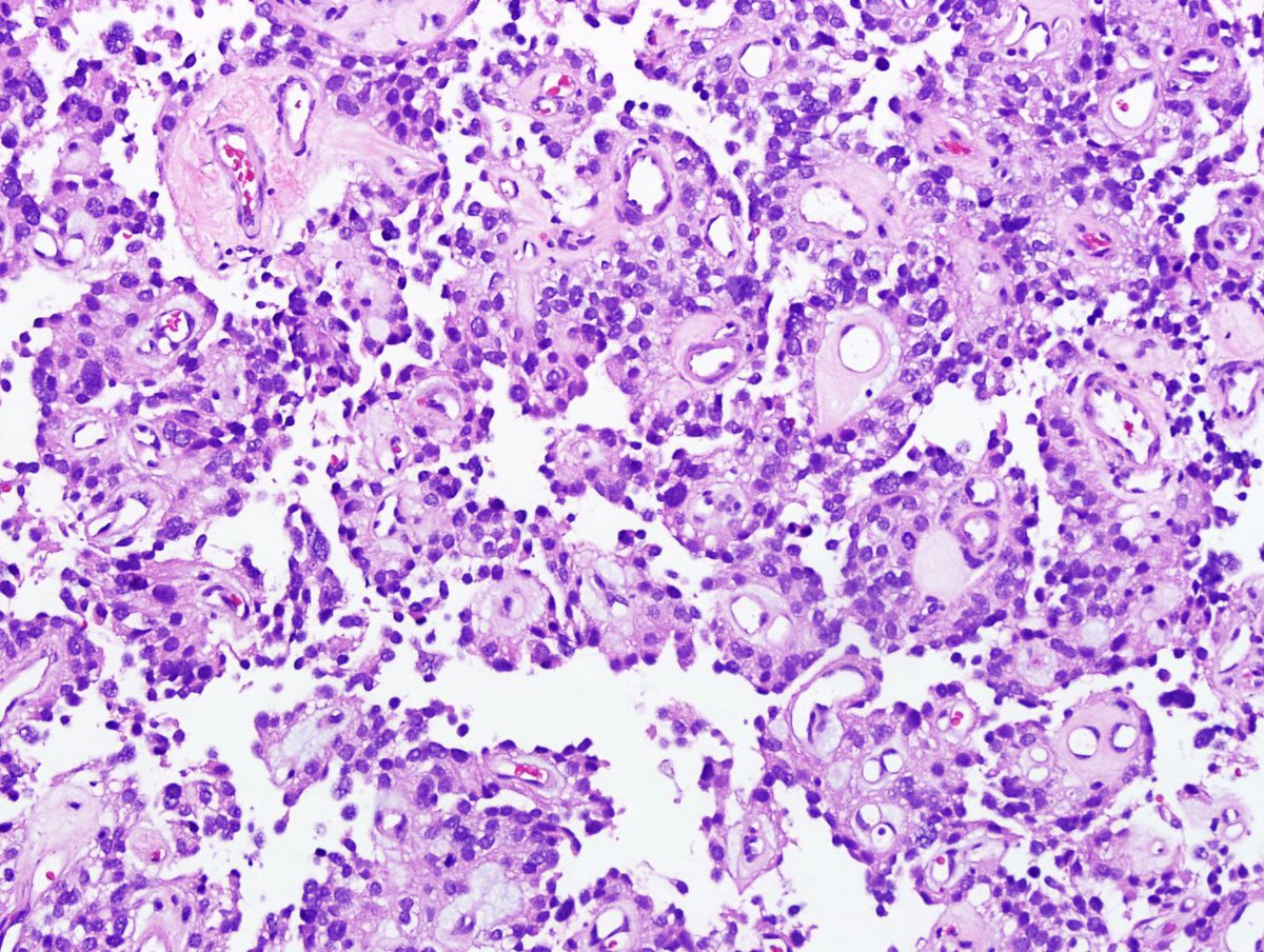 Hopkins Neuropath tweet media