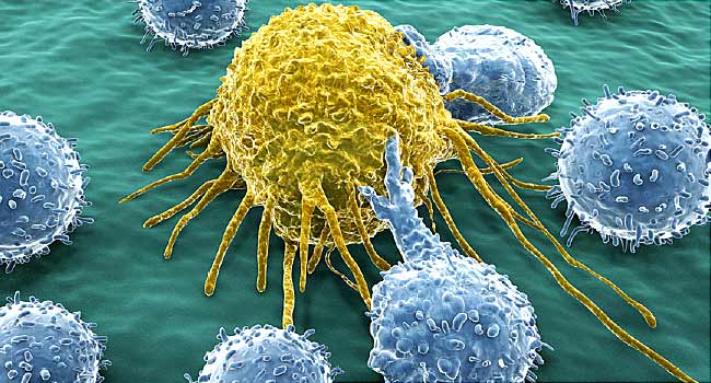 WebMD's tweet photo. Does this newly approved treatment for childhood leukemia offer hope in the fight against other forms of cancer? https://t.co/MpLCnbu5sJ https://t.co/6SZjk2tdlr
