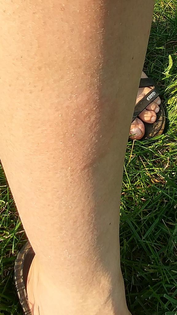 melissa_shepley's tweet photo. My son's first hit, hit me #RightInTheLeg can you tell?? #ItReallyHurt he #Laughed https://t.co/YtDlDqM72r