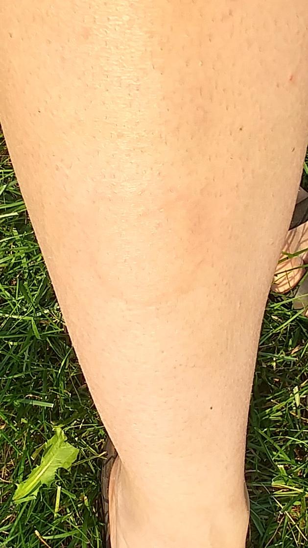 melissa_shepley's tweet photo. My son's first hit, hit me #RightInTheLeg can you tell?? #ItReallyHurt he #Laughed https://t.co/YtDlDqM72r