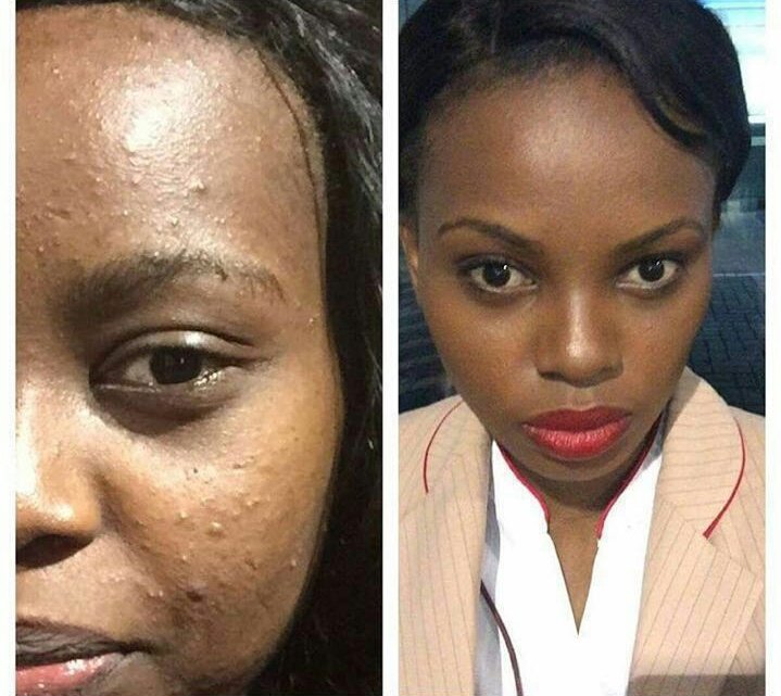 weredefineyouth's tweet photo. Real Women. Real Results.
#nomoreacne #clearskin #60days #skincareroutine #YoungerNow #Jeunesse #WellnessPoint
https://t.co/Tvm28hsgeN https://t.co/bVkAlPnYuu