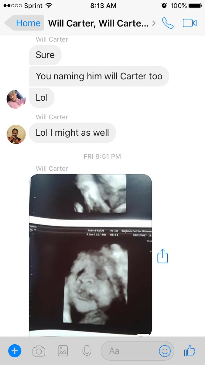 WillyCarts's tweet photo. So the other day this guy Will Carter made a group with a bunch of other Will Carters n somehow it led to ultrasound pics of his unborn son https://t.co/3rqwmVtDO1