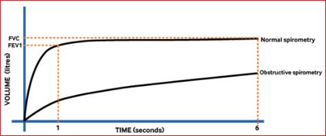 BMJLearning's tweet photo. Confident interpreting #spirometry results in a patient investigated for #cough? https://t.co/aWm9GsaCFS #meded #medtrainee #respiratory https://t.co/9Zdk7un2sh