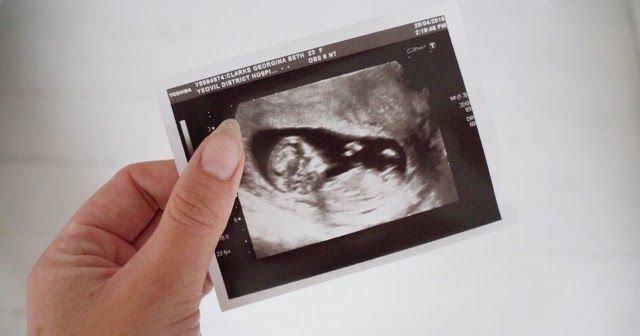 An open letter to all the ladies in their first trimester... 🤰🤰🤰 buff.ly/2eMvrvZ