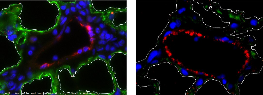ScienceMagazine's tweet photo. A new method successfully tested in rats may offer a promising approach for lung graft transplants: https://t.co/WNZ3E6xDqh @ScienceAdvances https://t.co/DCnI3qjNIU