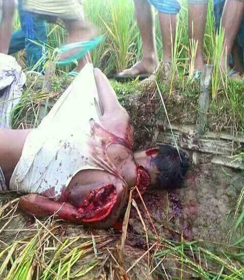 KhineMinMyat1's tweet photo. @Malala Hi Malala,he is a victim of #Bangali terrorists(so call#Rohingya )
He is a #Hinduism live in #Maungdaw ,#Rakhine state,Myanmar.
Can you see? https://t.co/kKkmFkgdNU